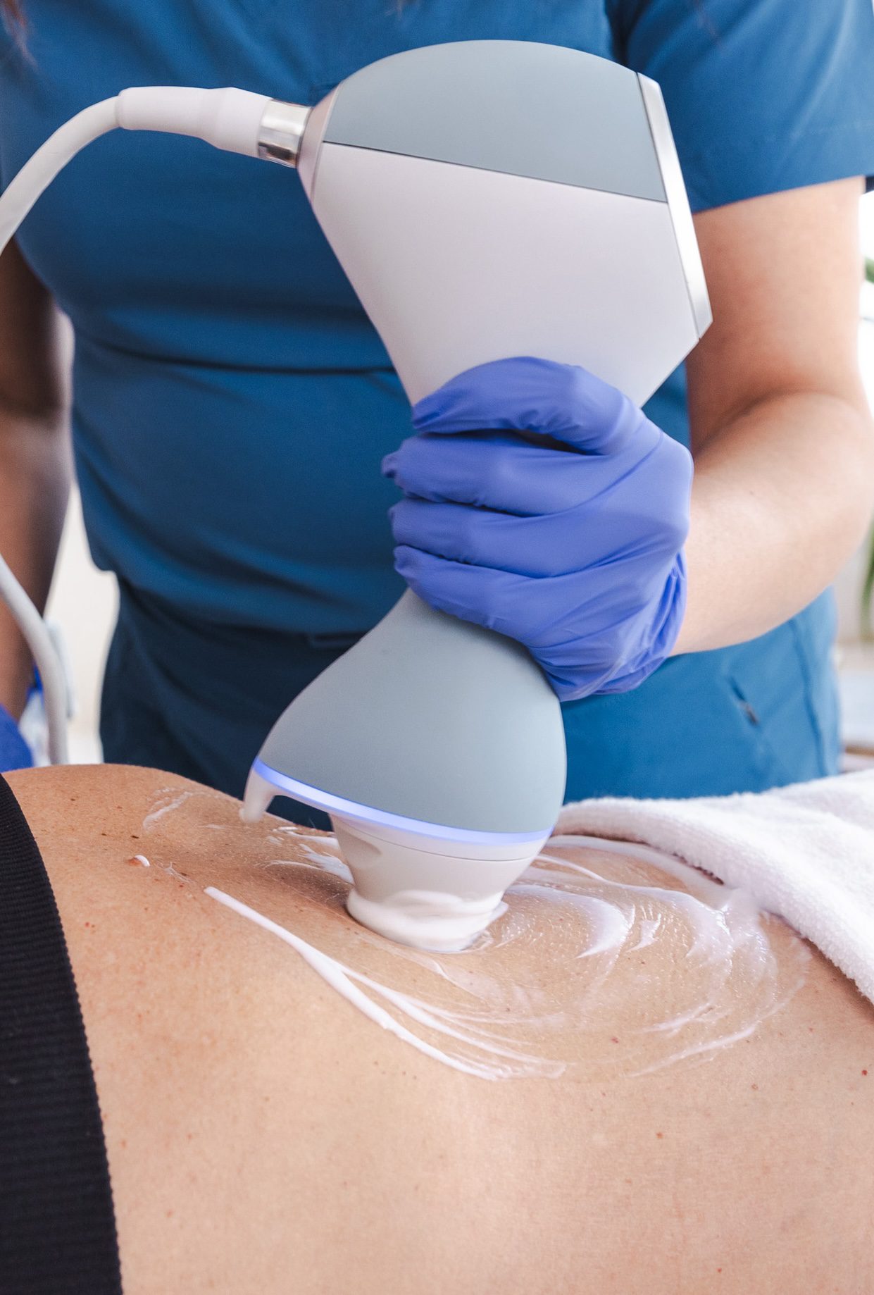 EMTONE cellulite treatment at iCRYO Port St. Lucie