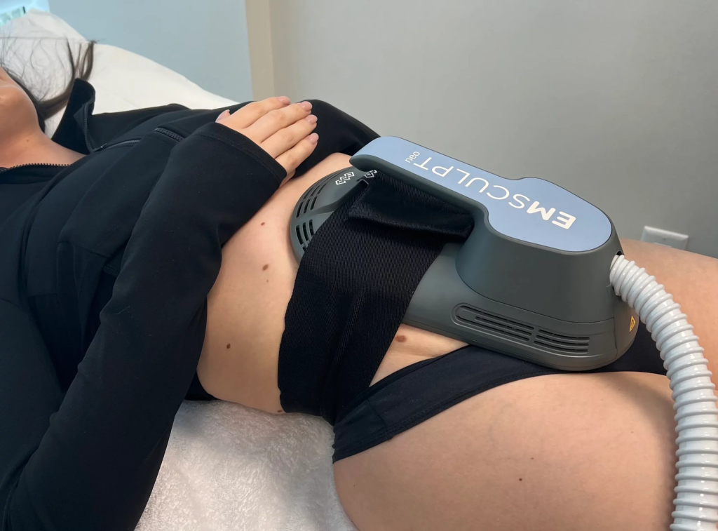 Emsculpt Neo session in progress at iCRYO Port St. Lucie
